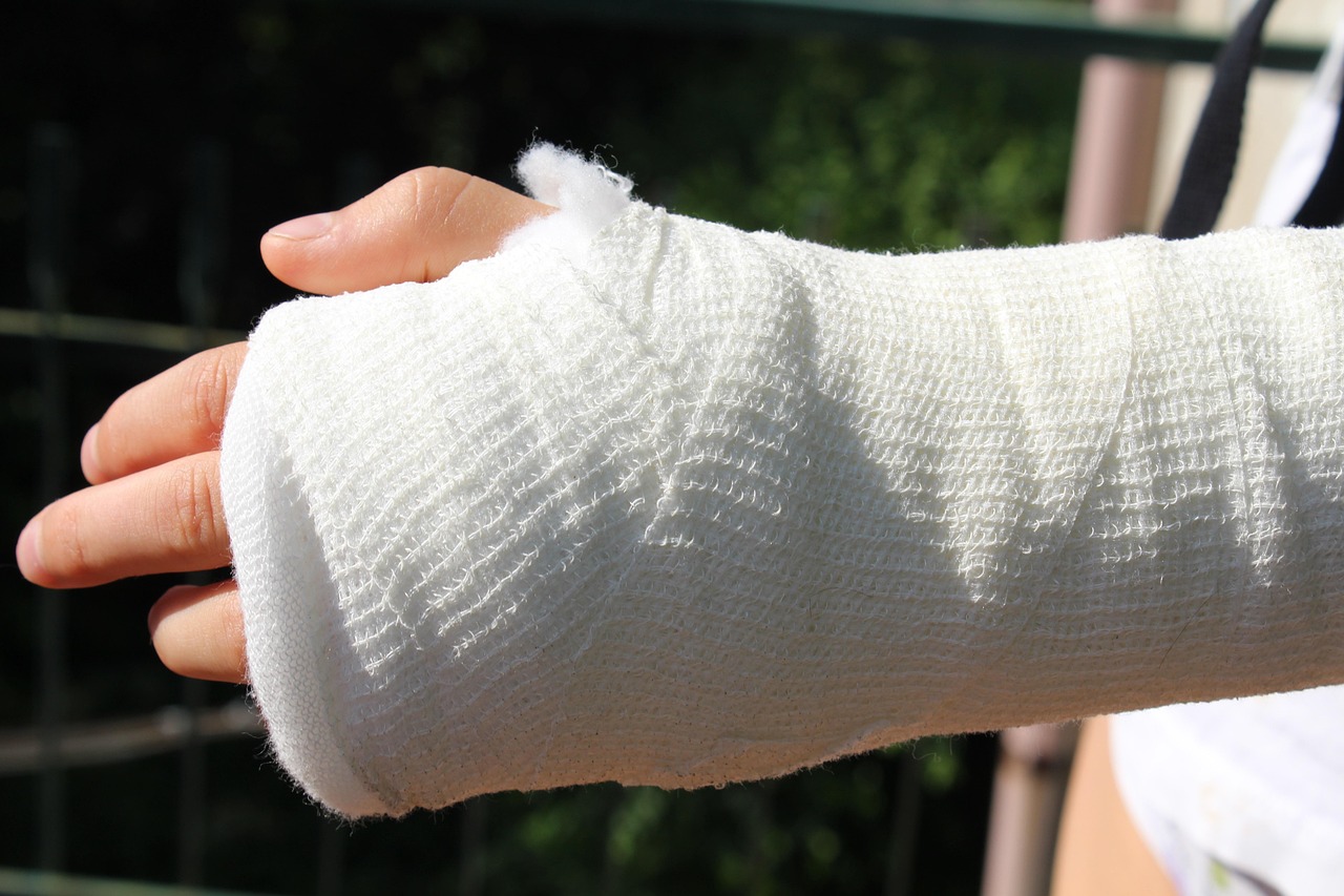 injury, orthopedics, chalk, bandage, treatment, accident, doctor, bandages, fracture, hand, forearm, hospital, emergency room, gauze, ache, bad, sprained, broken, medicine, health, injury, injury, injury, injury, injury, orthopedics, bandage, bandage, bandage, bandage, emergency room, emergency room, gauze