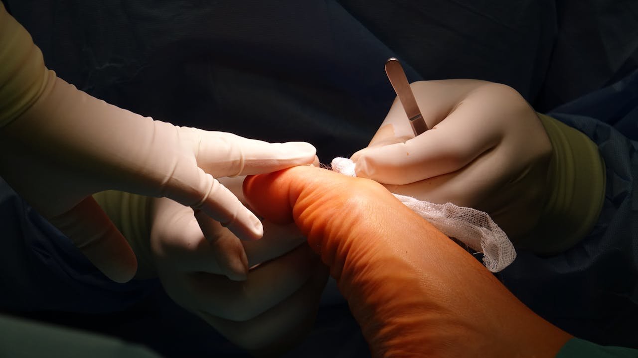 Close-up of a foot surgery in progress, showcasing medical expertise.